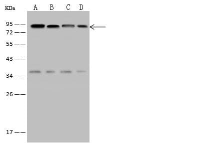EWSR1 / EWS Antibody