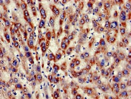 KIR3DL1 Antibody