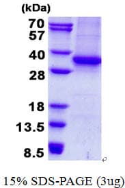 Human ASMT / HIOMT Protein (Recombinant His)