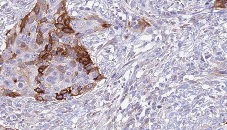 Polyclonal Rabbit anti-Human CD99 Antibody (IHC, WB)