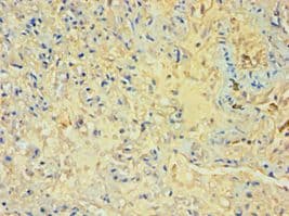 Polyclonal Rabbit anti-Human M-PST / STM Antibody (aa1-295, IHC, WB)