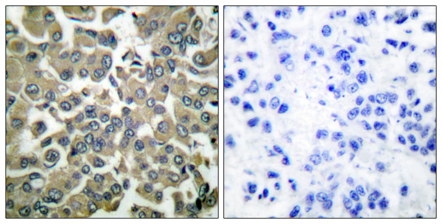 WNK1 Antibody (phospho-Thr58)
