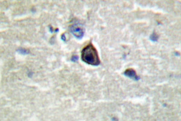 GRIA4 / GLUR4 Antibody (Lys858)