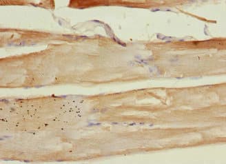 PLA2G4C Antibody