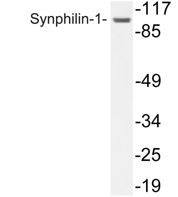 SNCAIP / Synphilin 1 Antibody (aa797-846)