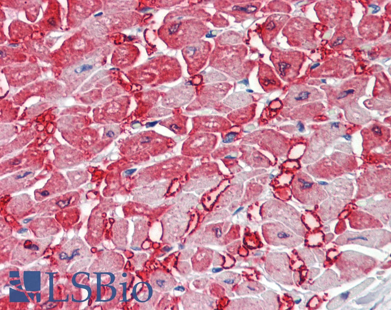 IHC-plus™ CKM / Creatine Kinase MM Antibody (Tyr14)
