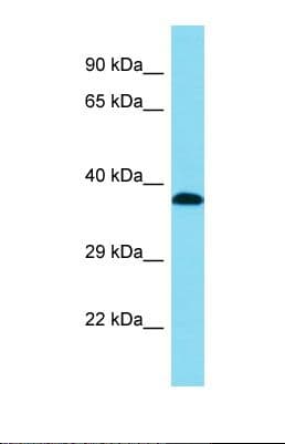 DHRS13 Antibody (C-Terminus)
