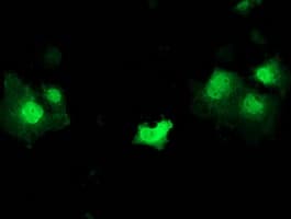 IHC-plus™ STAT5A Antibody (clone 9F7)