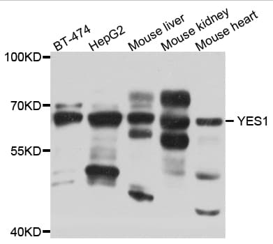 IHC-plus™ YES1 / c-Yes Antibody