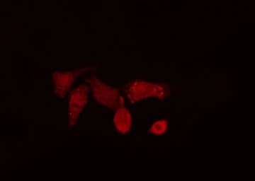 Polyclonal Rabbit anti-Human POLB / DNA Polymerase Beta Antibody (IHC, IF, WB)