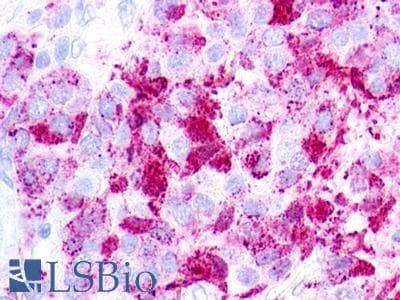 PathPlus™ Polyclonal Rabbit anti-Human GPR26 Antibody (Extracellular Domain, IHC)