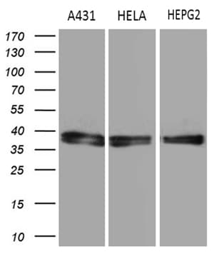 Monoclonal Mouse anti-Human TALDO1 / Transaldolase 1 Antibody (clone OTI1E5, IHC, WB)