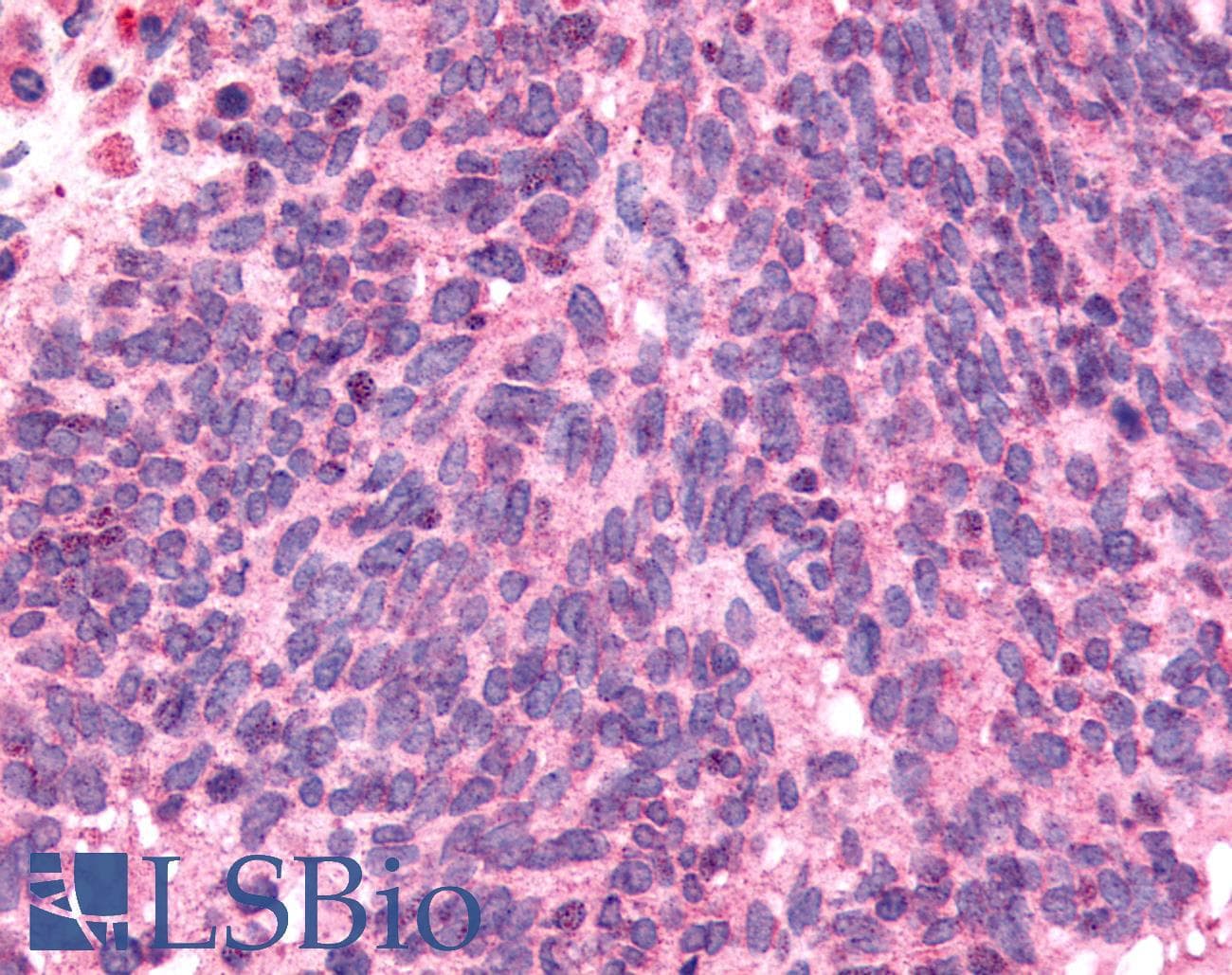 PathPlus™ NEK9 Antibody (Pro/Ser/Thr Rich Domain)