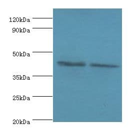 COPS4 / CSN4 Antibody (aa1-310)