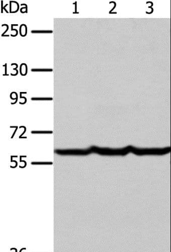 F9 / Factor IX Antibody