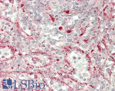 IHC-plus™ Polyclonal Rabbit anti-Human CXCL1 / GRO Alpha Antibody (Internal, IHC)