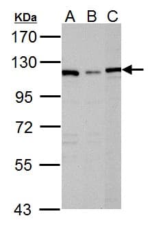 DPYD / DPD Antibody (aa1-174)