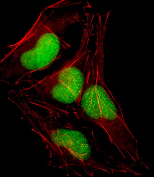 Polyclonal Rabbit anti-Human SOX18 Antibody (aa59-88, IF, WB)