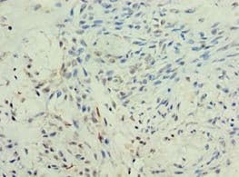 KMO Antibody (aa1-260)