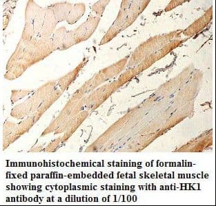 Polyclonal Rabbit anti-Human HK1 / Hexokinase 1 Antibody (aa351-629, IHC, WB)