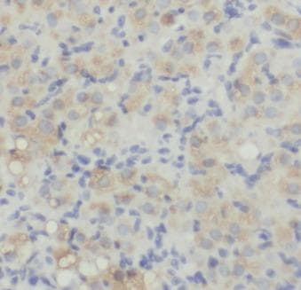 Polyclonal Rabbit anti-Human AMH / Anti-Mullerian Hormone Antibody (IHC, IF)