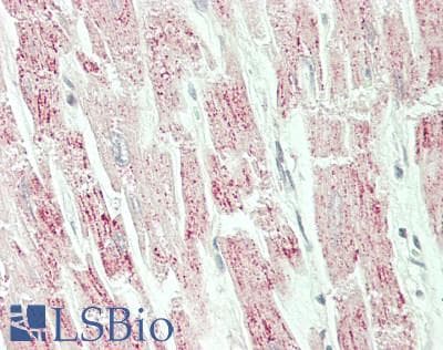 IHC-plus™ Polyclonal Rabbit anti-Human SLC25A20 / CACT Antibody (aa235-264, IHC, WB)