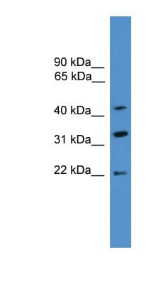 Polyclonal Rabbit anti-Human ARFIP1 Antibody (C-Terminus, WB)