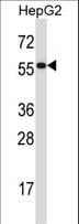 Polyclonal Rabbit anti-Human PDIA2 Antibody (aa210-239, WB)