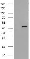 ADH2 / ADH1B Antibody (clone OTI5D7)