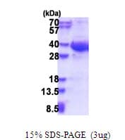 Human EXOSC8 Protein (Recombinant His)