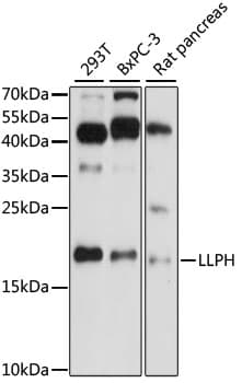 Polyclonal Rabbit anti-Human LLPH / C12orf31 Antibody (WB)