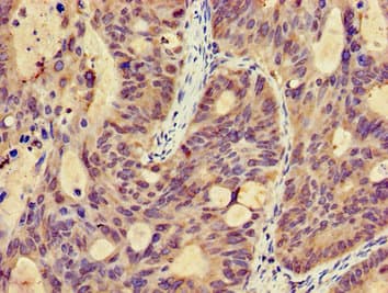 Polyclonal Rabbit anti-Human MICU2 / EFHA1 Antibody (IHC)