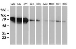ZFP36 / Tristetraprolin Antibody (clone OTI4B10)
