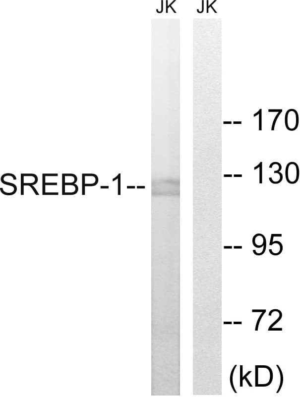 Polyclonal Rabbit anti-Human SREBF1 / SREBP-1 Antibody (aa405-454, IHC, WB)