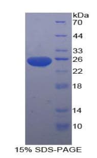 Rat SDF4 Protein (Recombinant His)