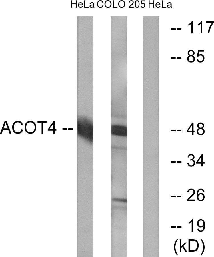 ACOT4 Antibody