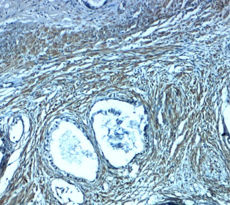 Polyclonal Rabbit anti-Human TMEPAI / PMEPA1 Antibody (IHC, WB)
