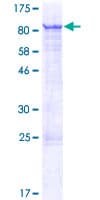 Human ZNF18 Protein (Recombinant GST)