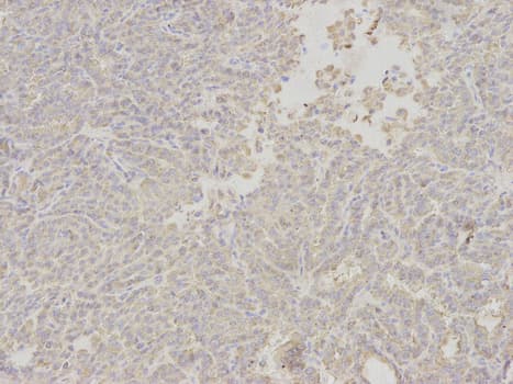 APOM / Apolipoprotein M Antibody