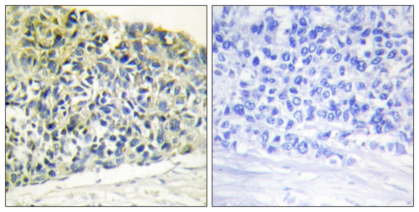 PEA15 / PEA-15 Antibody (phospho-Ser116)