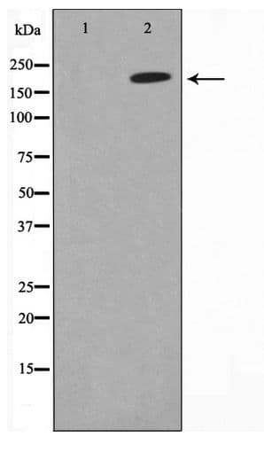 Polyclonal Rabbit anti-Human MAGI2 / AIP-1 Antibody (WB)