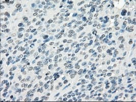 FRA-1 / FOSL1 Antibody (clone OTI12F9)
