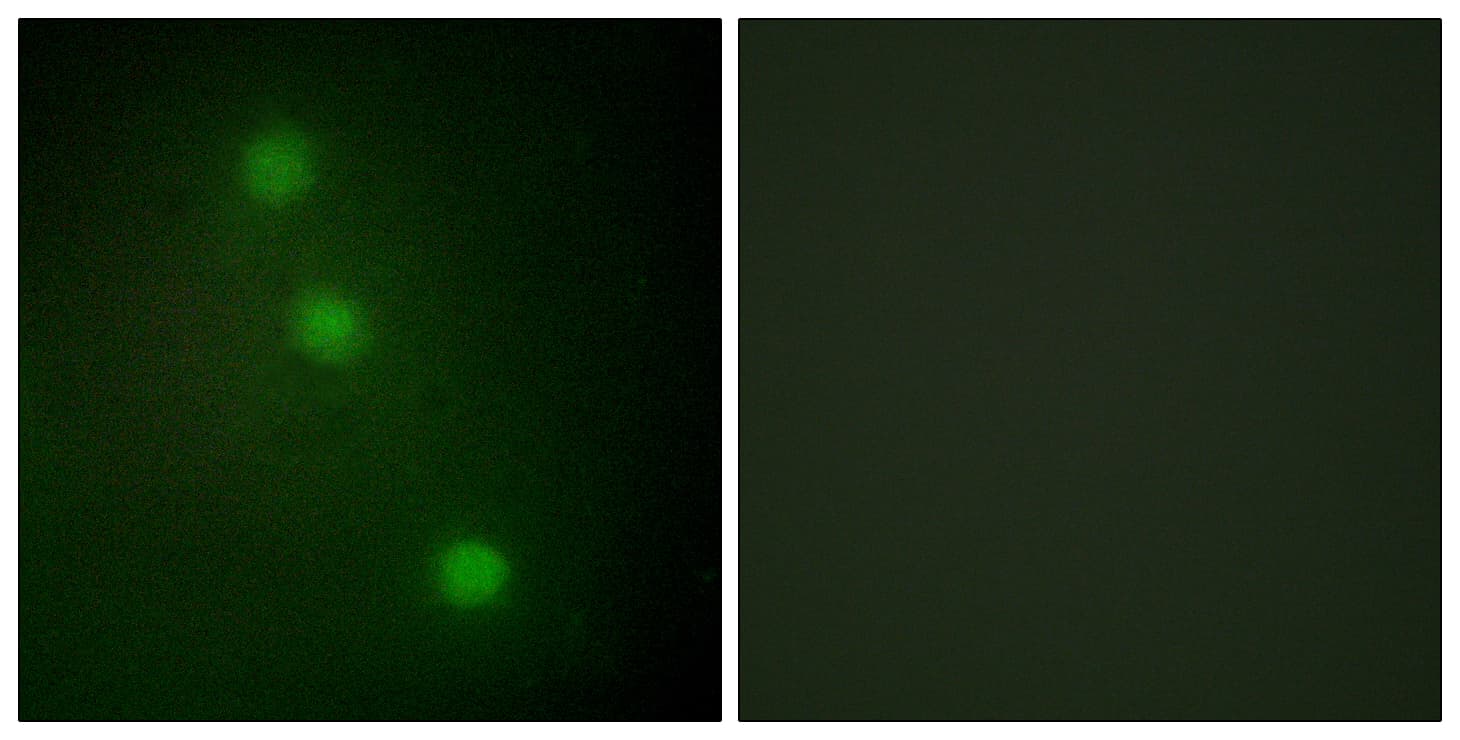 IHC-plus™ ATF1 Antibody (aa176-225)
