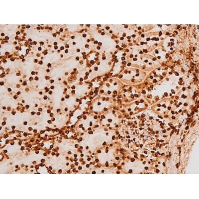 REL / C-Rel Antibody (phospho-Ser503)