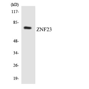 ZNF23 Antibody (aa136-185)