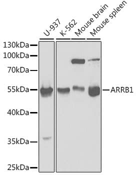 Polyclonal Rabbit anti-Human ARRB1 / Beta Arrestin 1 Antibody (IHC, IF, WB)