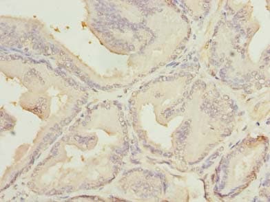 MED18 Antibody