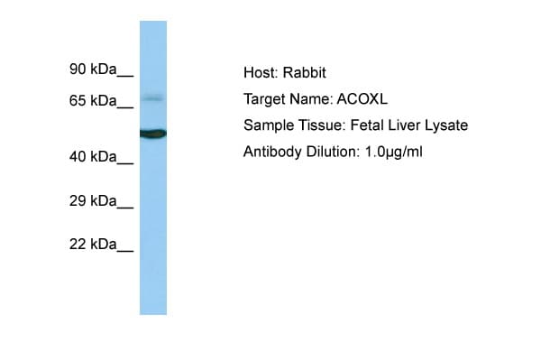 ACOXL Antibody (aa263-312)