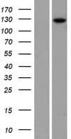 PHKB Protein (Over-Expression Lysate Myc-DDK (Flag))