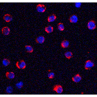 Polyclonal Rabbit anti-Human TRPC6 Antibody (IHC, IF, WB)